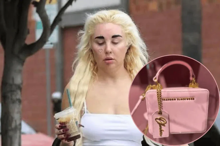 Amanda Bynes Now: What She Looks Like and What She’s Doing in 2026